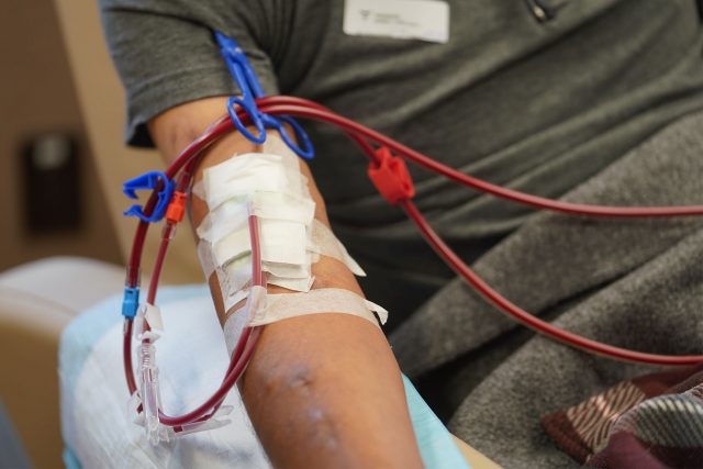 Kalani Pagan receives dialysis during a 5-week training on how to use the machines with registered nurse Linda Tsui RN. The process takes a little under 3 hours.